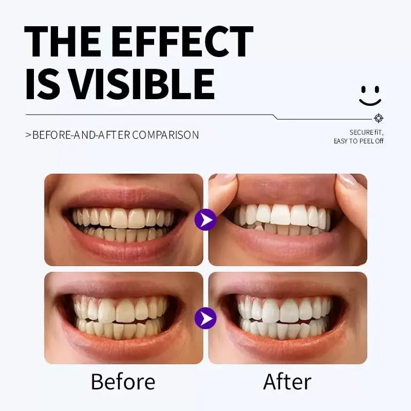 Purple Teeth Whitening Strips Kit – 7-Day Enamel Safe Whitening Treatment (14 Strips)