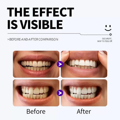 Purple Teeth Whitening Strips Kit – 7-Day Enamel Safe Whitening Treatment (14 Strips)